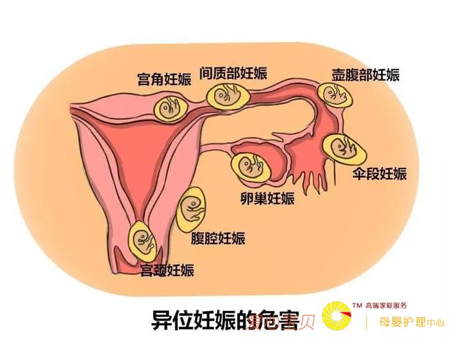 ĸӤɱ�֡�����λ����