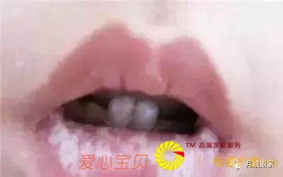 ��������5��״�����������3�֣�����ɩ��������ĸ���