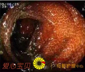 ������ʲ�Ʒ��Ч������������ 1000 �����Ժ��֡���